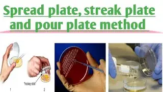 Streak plate,  pour plate and spread plate method