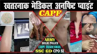 ख़तरनाक मेडिकल अनफ़िट पॉइंट || SSC GD || CPO SI || ARMY || CRPF TRADESMAN || DELHI POLICE ||
