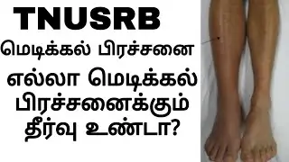 TNUSRB Medical Leg Problems 2020 | TNUSRB Medical Test Details 2020
