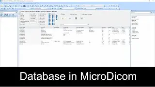 How to Use the Database Feature in MicroDicom | DICOM Viewer Tutorial