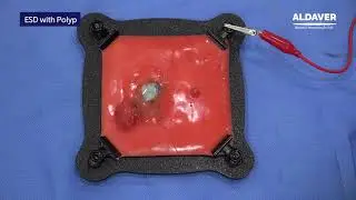 ESD Training Model with Polyp - ALDAVER Surgical Simulators