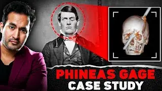 Phineas Gage case @GetSetFly