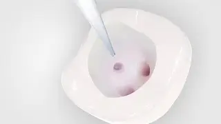 Root Canal Treatment / Cleaning | Dental Animation