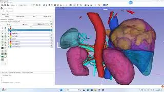 Automated 3D Reconstruction Showcase for Contrast-Enhanced Abdominal CT