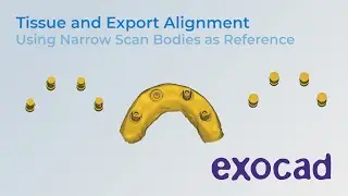 Nexus Connect Lab - Aligning Tissue Scan with Narrow Scan Bodies to Exports (Exocad)