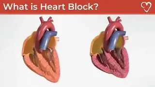 What is Heart Block?