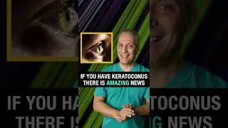 This NEW Keratoconus Treatment RESTORES Your Vision!