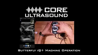 Butterfly iQ+ Basic Machine Operation
