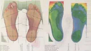 video cad cam produzione plantari  barapodometria compiuterizzata