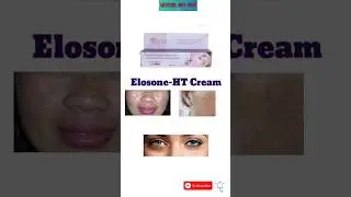 Elosone- HT cream uses || Elosone - HT shoking result #ytshorts
