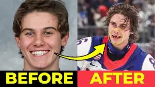 Jack Hughes Loses Teeth! 😱 USA vs Canada Brutal Moment