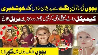 Forget Chemical Creams | Best Herbal Skin Care for Children | Tips & Tricks by Naeema Appa | City42