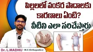 పిల్లలలో వంకర పాదాలకు కారణాలు || Clubfoot Symptoms Causes and Treatment || One Hospitals