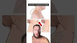 La soluci&oacute;n a la joroba de b&uacute;falo es esta