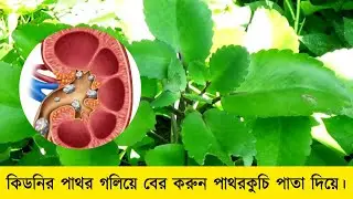 Dissolve kidney stones with crushed leaves. #Hakim_Bokul #Dr.Bokul