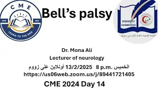 Bell's palsy tips & tricks, Dr. Mona Ali, Lecturer of neurology Beni-Suef