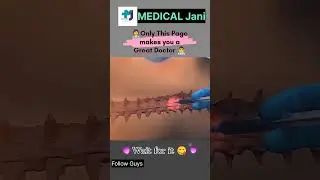 A cesarean section 3d animation video (C-section) #explorepage #medicaljani #csection #cesarean