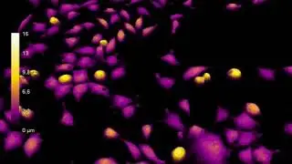 Giant mouse L929 fibroblast engulfs dying cell | HoloMonitor&reg;