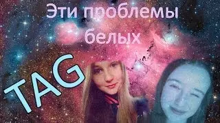 TAG: Эти проблемы белых
