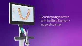 How to scan a single crown with the iTero Element&trade; Plus scanner | step-by-step execution