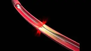 Optical coherence tomography - Animation of C7 deployment