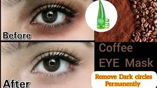 &ldquo;Aloe Vera + Coffee Powder for Dark Circles | 100% Natural Remedy | Dark Circles Remove Fast&rdquo;