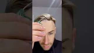 🔥Magic Transformation: Witness the Instant Confidence with Lordhair #hairloss #hairsystem #toupee