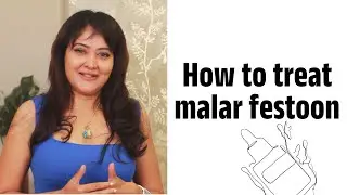 Best ways to treat Malar Festoon | Dr. Shuba Dharamana | Dermatologist | Lejeune Medspa