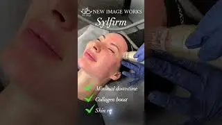 Sylfirm X RF Microneedling | Skin Tightening & Rejuvenation at New Image Works Med Spa