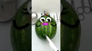 Top Doctor Reveals 5 Watermelon Surgery Techniques You Never Knew Existed