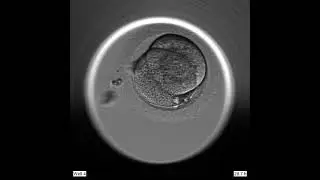 Preimplantation embryo development: time lapse video