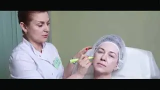 Особенности нитей Резорблифт