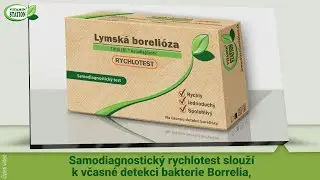 Lymsk&aacute; boreli&oacute;za Rychlotest - Vitamin Station
