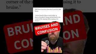 Trump&rsquo;s Bruises and Confusion on Display