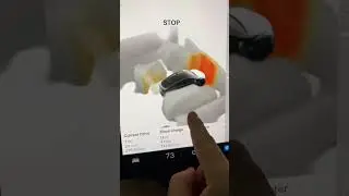 Tesla vision park assist update is amazing