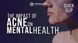 The impact of acne on mental health