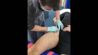 Notes on Needling 18: Anatomy hacks for needling the anterior hip.