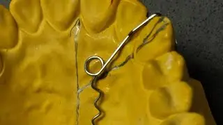 Simple finger spring, Part 2- د. حيدر الزريجاوي 