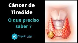 Câncer De Tireooide: O Que Preciso Saber? [Dr. Rogério Leite]