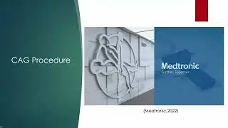 Dr. Gary Liu on Cyanoacrylate Glue Ablation: 氰基丙烯酸酯胶塞脉治疗并发症 | 刘高瑞的超声案例分析 # 2023GVF