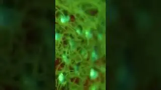 Fluorescent Coral under the water. || Unfolded Nature ||
