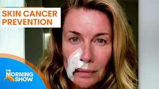 Skin cancer symptoms and prevention with Deborah Hutton