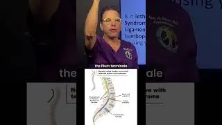 Asking the right questions about Tethered Cord Syndrome