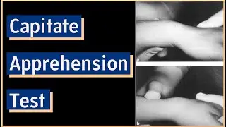 Capitate Apprehension Test | Carpal Instability