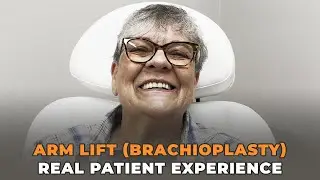 Arm Lift (Brachioplasty) - Real Patient Experience