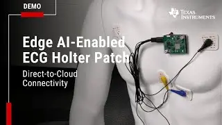Direct to cloud ECG wearable with Sony