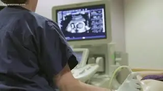 Where abortion laws stand a year after the Supreme Court overturned Roe