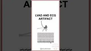 LVAD AND ECG ARTIFACT, #shorts