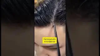 Invisible hair system | v-loop hairpatch