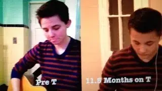 Pre-T vs 11.5 Months on T - Singing Voice Update